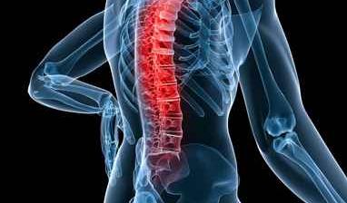 Rückenschmerzen zählen zu den häufigsten Volkskrankheiten Menschlicher Körper mit Skelett